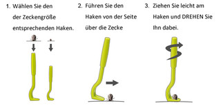OTOM Zeckenhaken